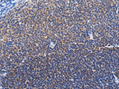 Anti-SYK / Spleen tyrosine kinase Antibody