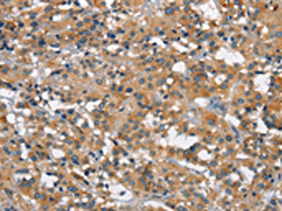 Anti-SMAD1 Antibody