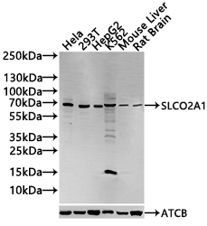 Anti-SLCO2A1 Antibody