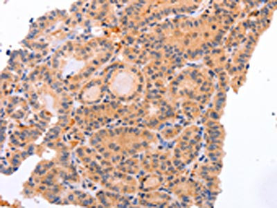 Anti-NR3C1 Antibody