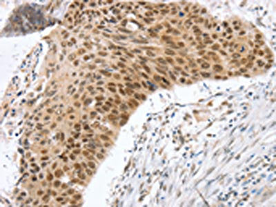 Anti-RNF20 Antibody