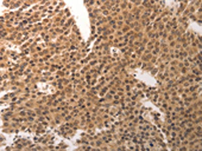 Anti-CDC6 Antibody