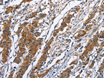 Anti-NCAPD3 Antibody