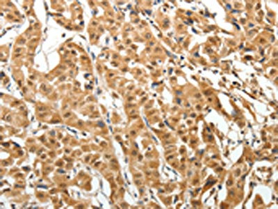 Anti-MAP1A Antibody