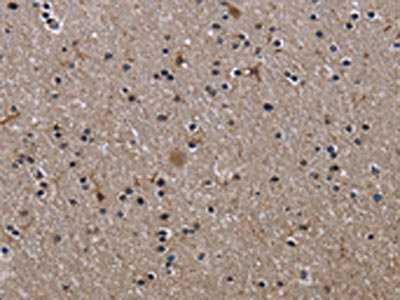 Anti-ITGB2 / CD18 Antibody