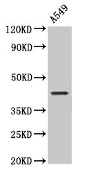Anti-NDRG4 Antibody