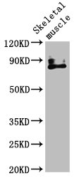 Anti-TRPV2 Antibody