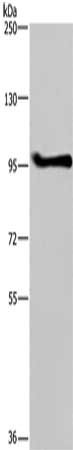 Anti-LLGL1 Antibody