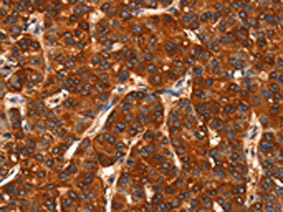 Anti-DHH / Desert hedgehog protein Antibody