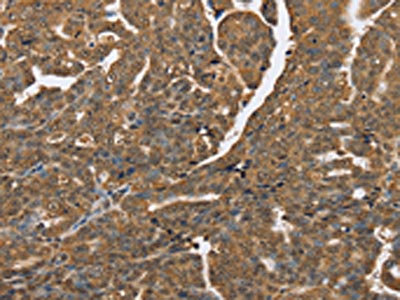 Anti-PTPN20A Antibody