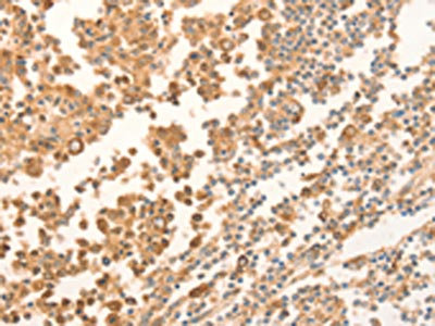 Anti-NAP1L1 Antibody