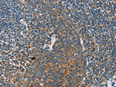 Anti-INHBA / Inhibin beta A chain Antibody