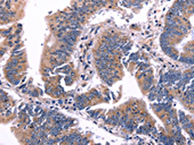 Anti-ARC / Activity-regulated cytoskeleton-associated protein Antibody