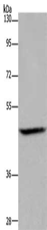 Anti-ETS2 / Protein C-ets-2 Antibody