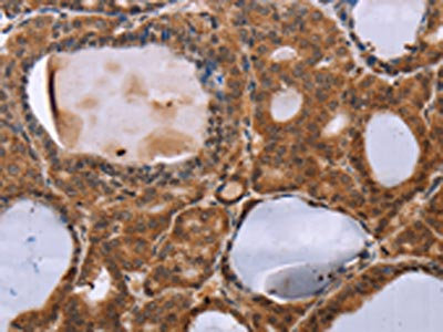 Anti-NDUFA2 Antibody