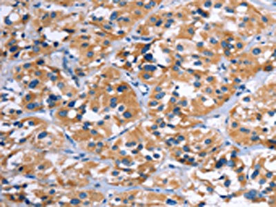 Anti-COMP Antibody