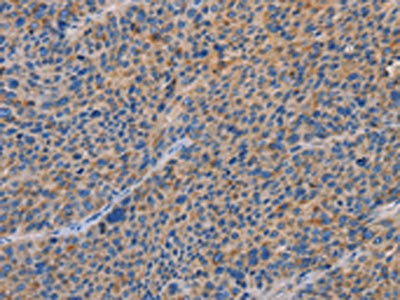 Anti-SPAG6 Antibody
