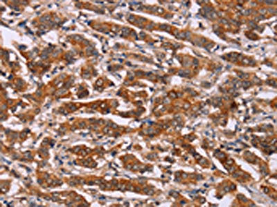 Anti-CYP2W1 / Cytochrome P450 2W1 Antibody
