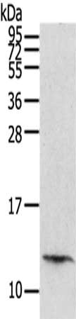 Anti-PBOV1 Antibody