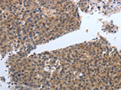 Anti-PDGFB Antibody