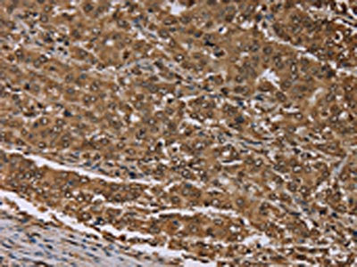 Anti-MEIS1 Antibody
