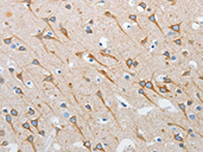 Anti-INTS1 / Integrator complex subunit 1 Antibody