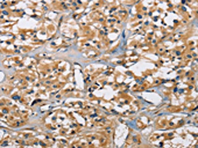 Anti-PPP3CA Antibody