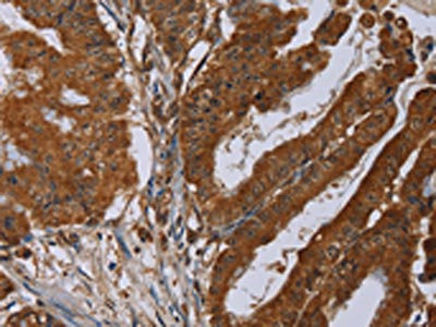Anti-SLC22A2 Antibody