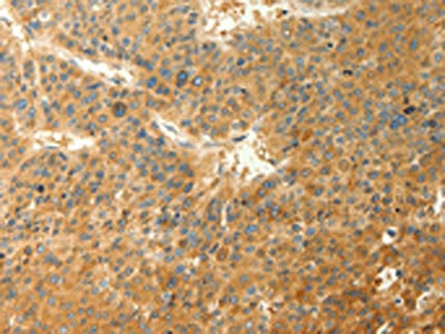 Anti-RAB35 Antibody