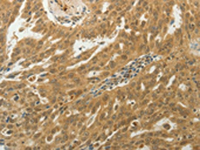 Anti-MYSM1 Antibody