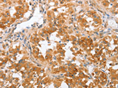 Anti-CRELD2 Antibody