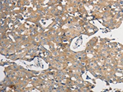 Anti-PPP2CB Antibody