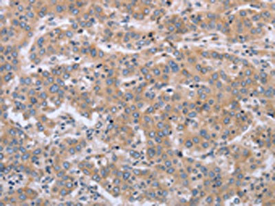 Anti-MAPRE3 / ECE1 Antibody