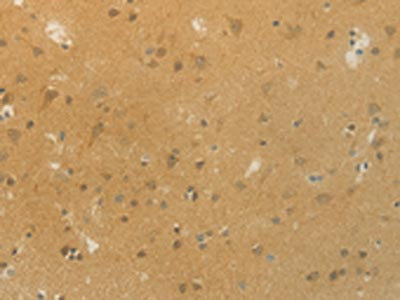 Anti-SLC9A3 Antibody