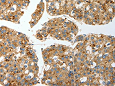Anti-PRCP Antibody