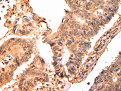 Anti-CAPNS1 Antibody