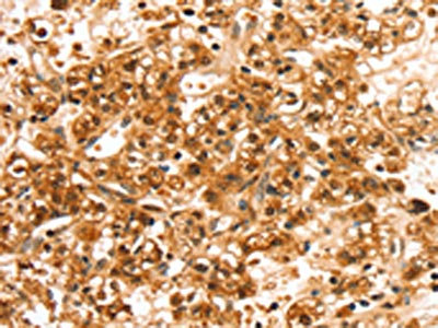 Anti-SLC44A2 Antibody