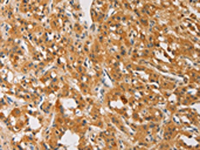 Anti-ATG4D / Autophagy related 4D