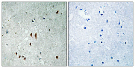 Anti-Phospho-CNOT2 (Ser101) Antibody