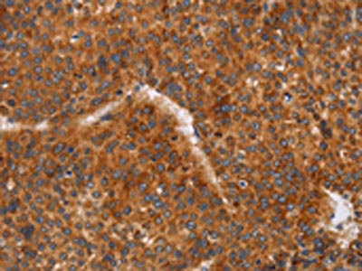 Anti-CD38 Antibody