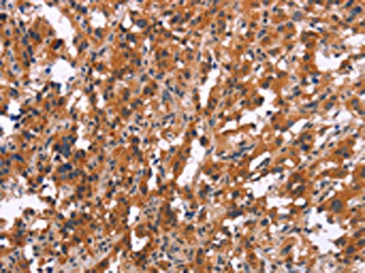 Anti-MAPK11 Antibody