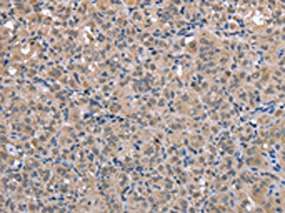Anti-FOXO1 Antibody