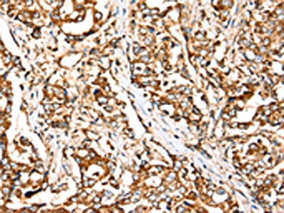 Anti-SIGLEC11 Antibody