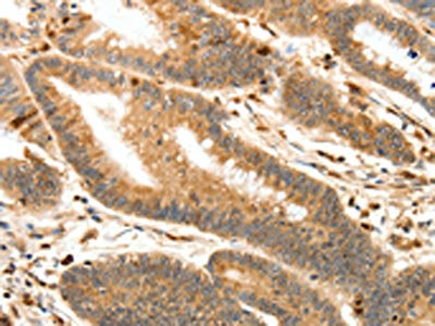 Anti-S100A4 Antibody