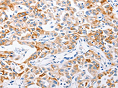 Anti-MMP10 Antibody