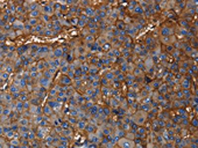 Anti-CD46 Antibody
