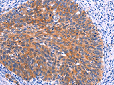 Anti-PTPN13 Antibody