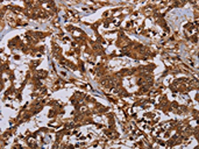 Anti-MOB1A Antibody