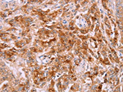 Anti-LPCAT4 Antibody