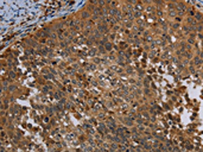 Anti-OSM Antibody